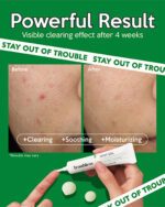 Crema hidratantă și calmantă Hydro Soothing, Troubless, 70ml - Imagine 2