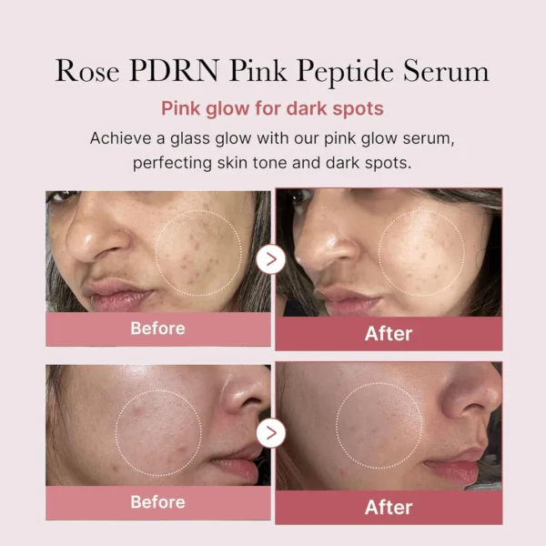 Medicube - Ser pentru ten, PDRN Pink Peptide, 30ml - Imagine 4