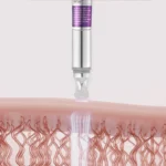 VT Cosmetics - Crema de ochi anti-rid Reedle Shot Lifting, 15ml - Imagine 3