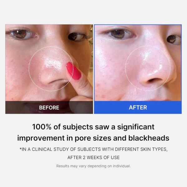 Medicube – Zero Pore Pad 2.0 70 Pcs - Imagine 2